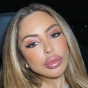 random model