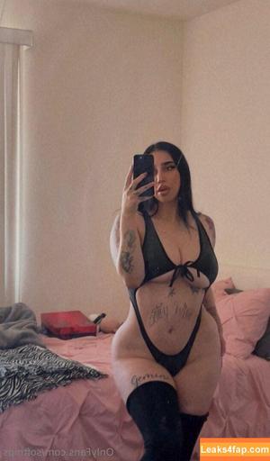 softnips photo #0011