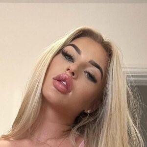 random model