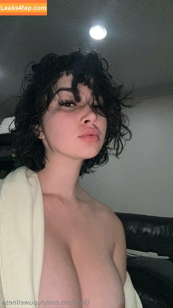 Liz / Lupuwellness leaked photo photo #0068