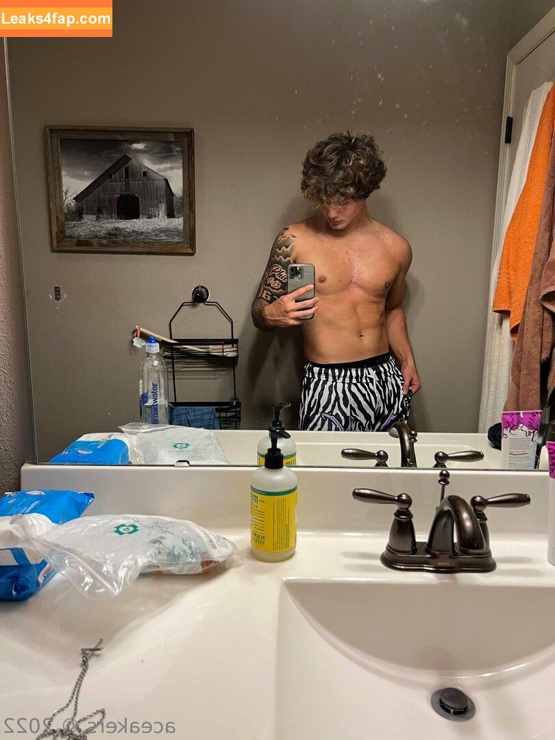 aceakers /  leaked photo photo #0013