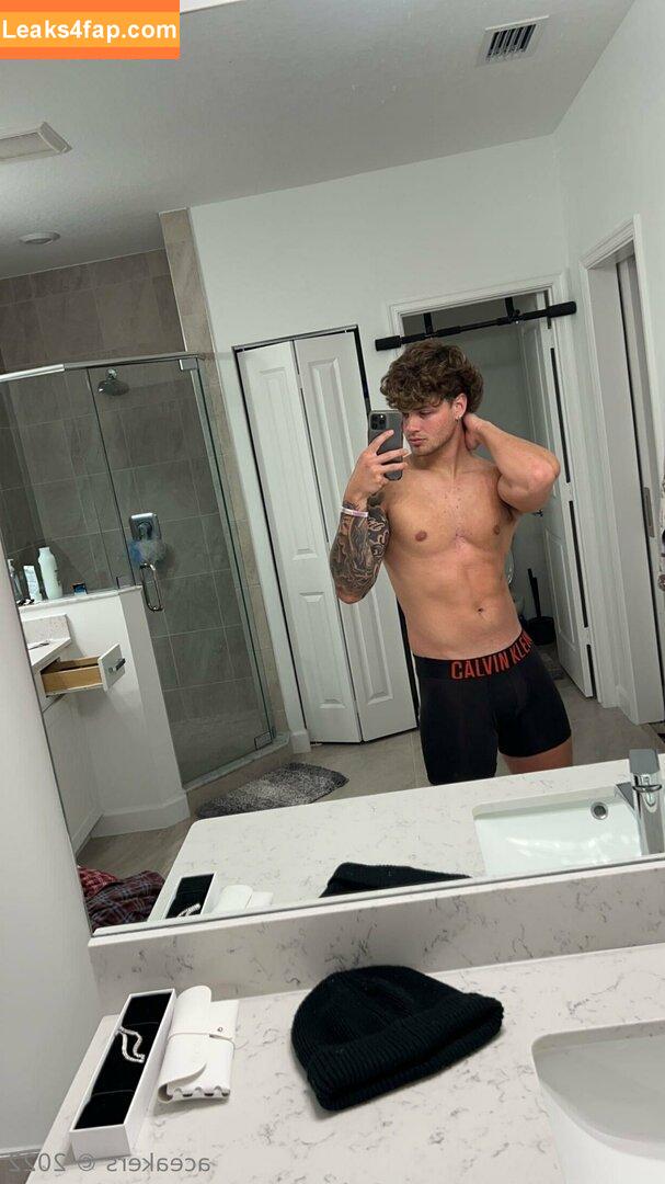 aceakers /  leaked photo photo #0030