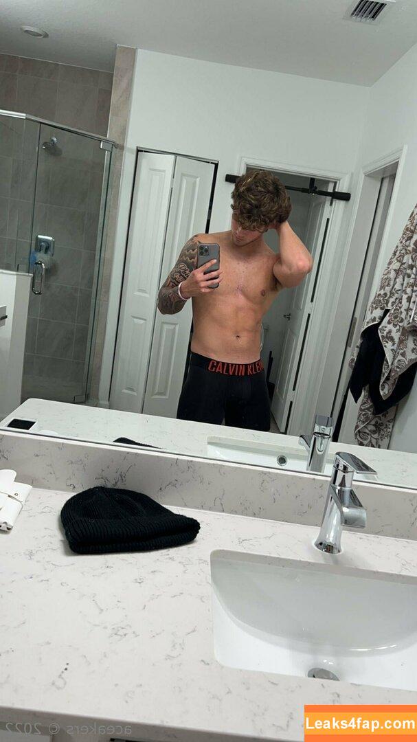 aceakers /  leaked photo photo #0032