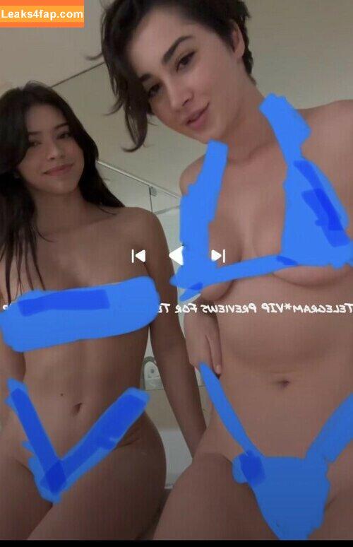 Lupuwellness leaked photo photo #0006