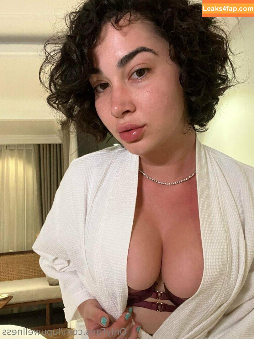 Lupuwellness leaked photo photo #0016