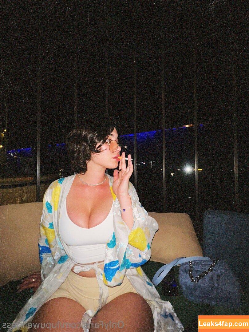 Lupuwellness leaked photo photo #0041