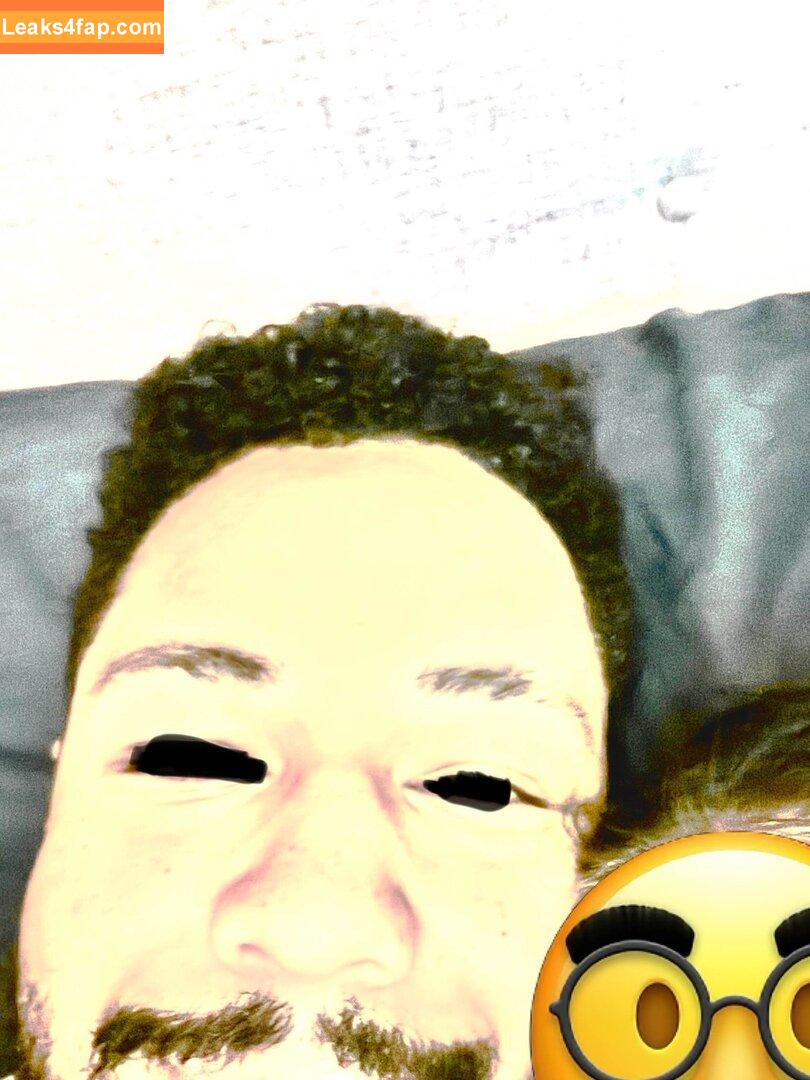 itskatchii / itskaitiecali / twitch career and liver failure speedrunner - leaked photo photo #0014