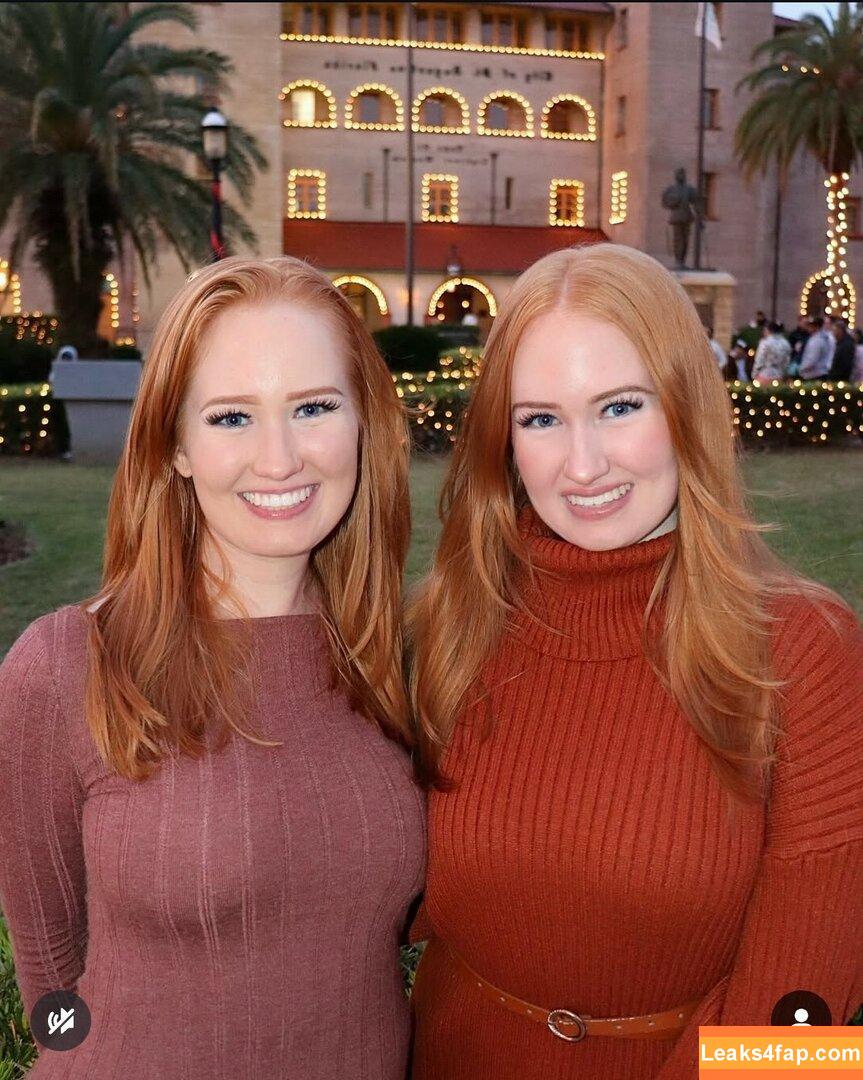 Burinski Twins / Ashley e Kayley / Gêmeas Burinski / ashleyburinski leaked photo photo #0202