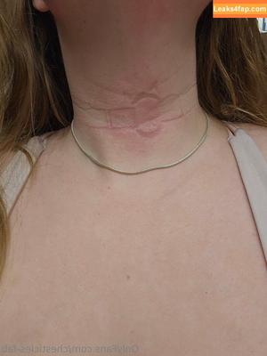 chesticles-fab photo #0072