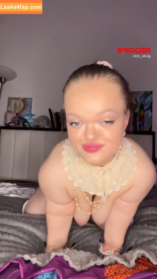 Disabled Girls / emilyladau leaked photo photo #0014