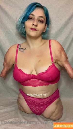 Disabled Girls photo #0021