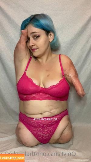 Disabled Girls photo #0022