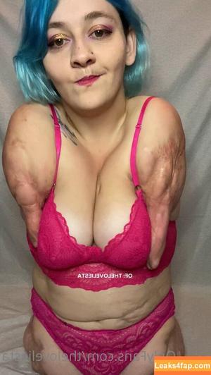 Disabled Girls photo #0023