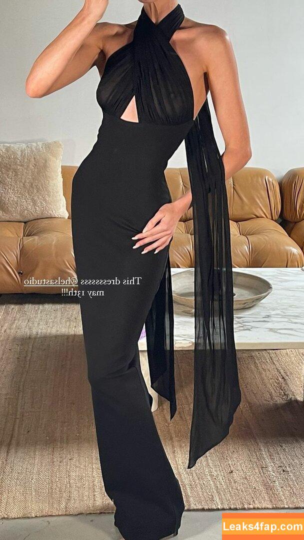 Elsa Hosk / elsahosk / hoskelsa / https: слитое фото фото #0578