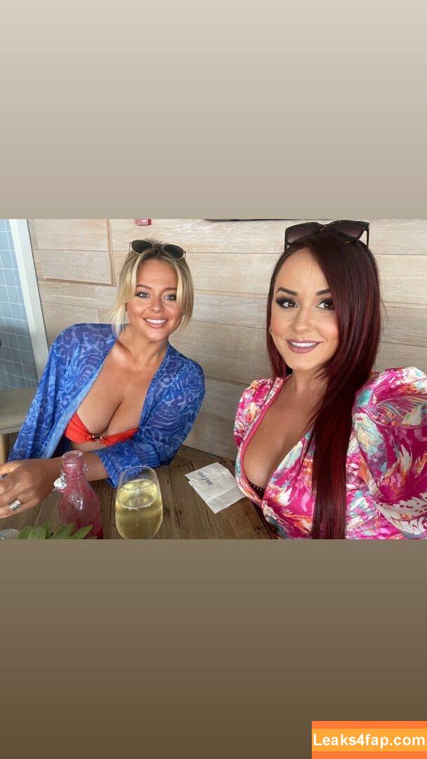 Emily Atack / emilyatack leaked photo photo #0318