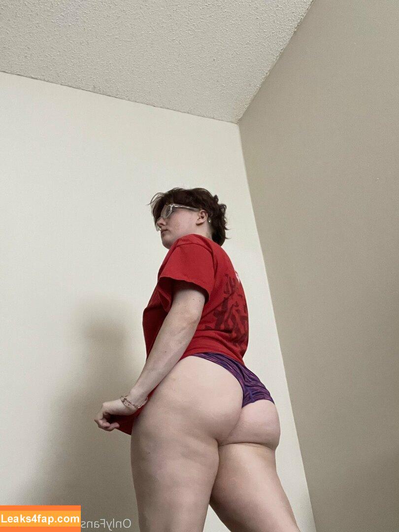 holykoley / luvurteeth leaked photo photo #0035