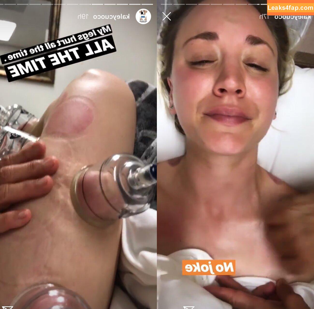 kaleycuoco /  leaked photo photo #0020