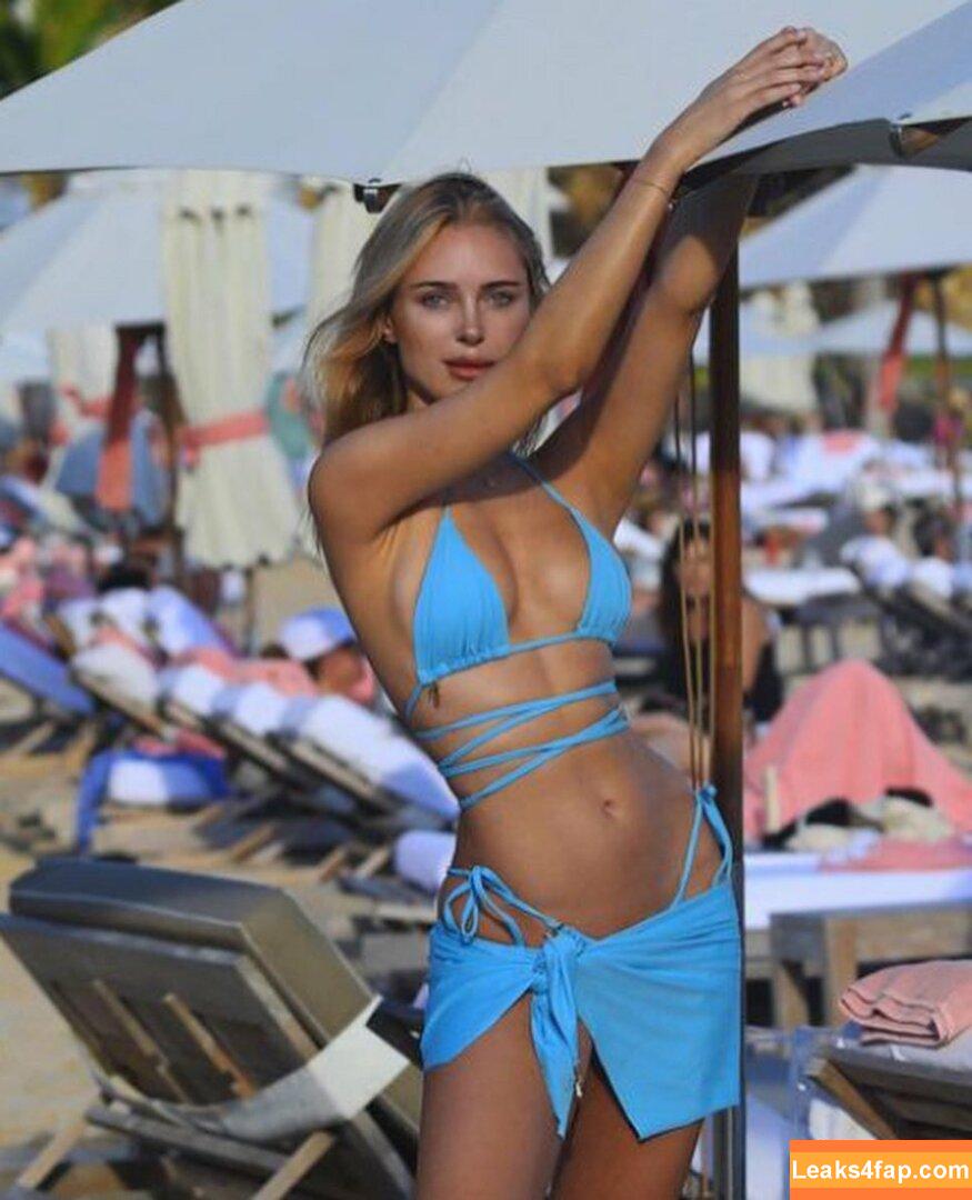Kimberley Garner / https: / kimberleygarner / kimberleylondon / officialkimberleygarner leaked photo photo #0438