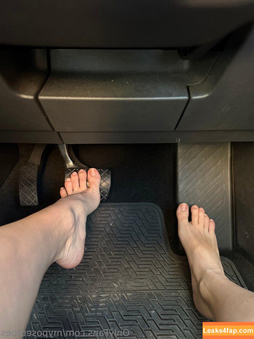 myposedtoes / myposedt0es leaked photo photo #0159