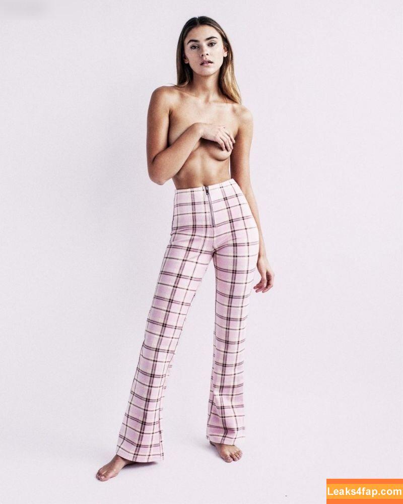 Stefanie Giesinger / stefaniegiesinger / steffigiesinger leaked photo photo #0023