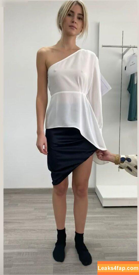 Stefanie Giesinger / stefaniegiesinger / steffigiesinger leaked photo photo #0071