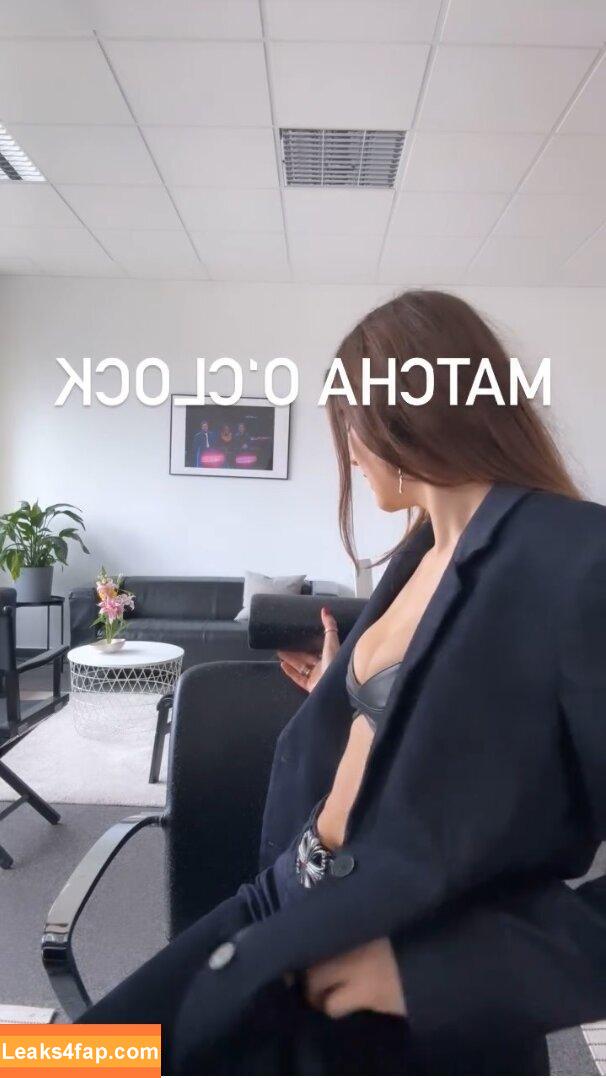 Stefanie Giesinger / stefaniegiesinger / steffigiesinger leaked photo photo #0152
