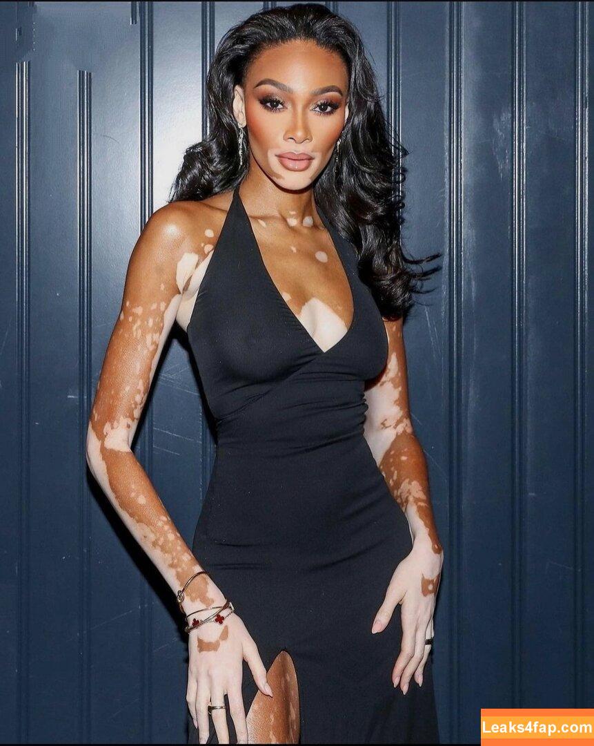 Winnie Harlow / winnieharlow слитое фото фото #0003