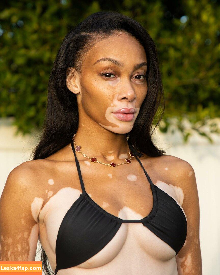 Winnie Harlow / winnieharlow слитое фото фото #0035