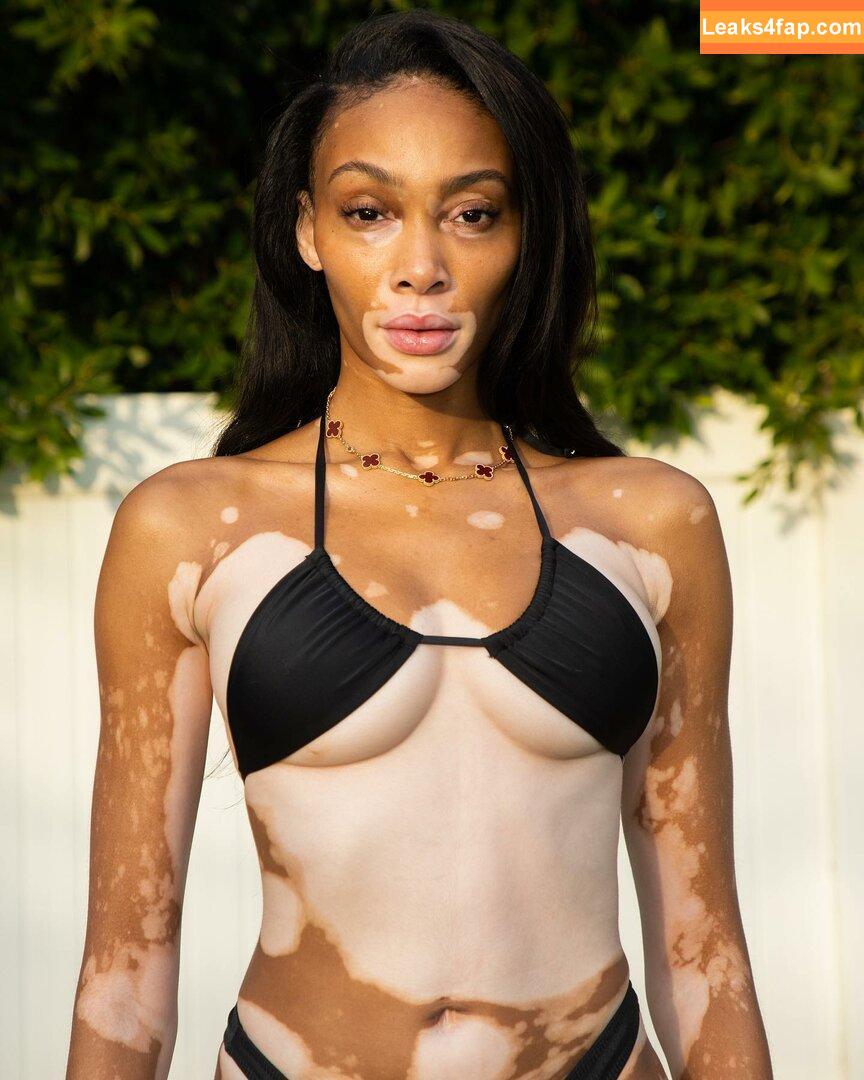 Winnie Harlow / winnieharlow слитое фото фото #0037