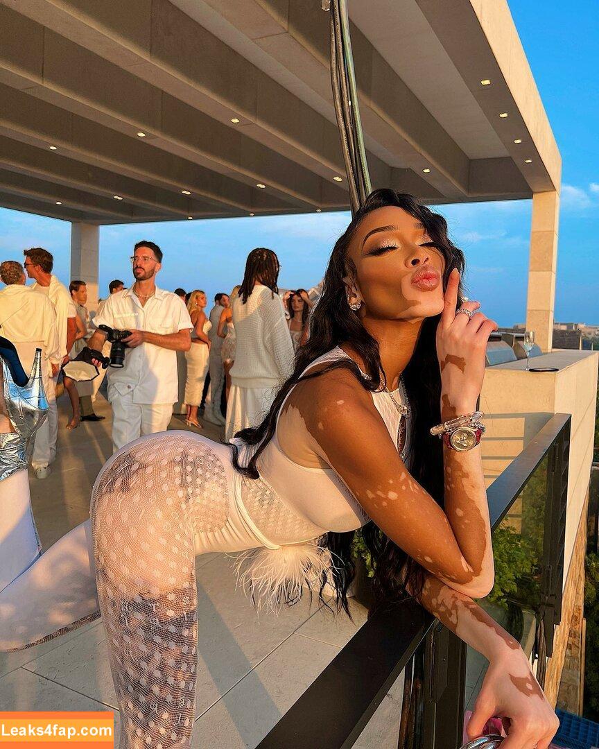 Winnie Harlow / winnieharlow слитое фото фото #0058