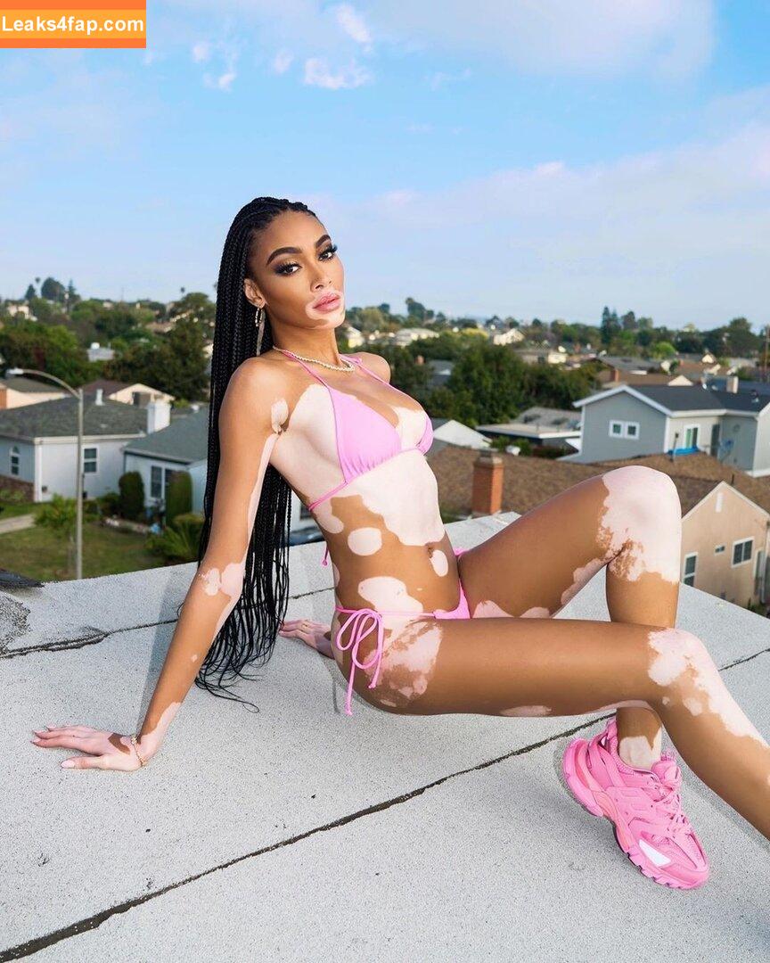 Winnie Harlow / winnieharlow leaked photo photo #0062