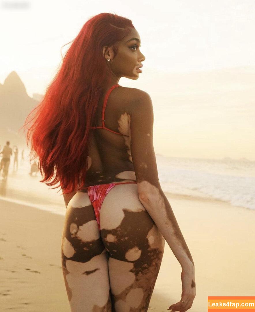 Winnie Harlow / winnieharlow leaked photo photo #0068