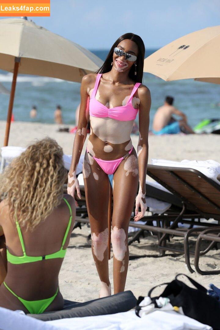 Winnie Harlow / winnieharlow leaked photo photo #0082