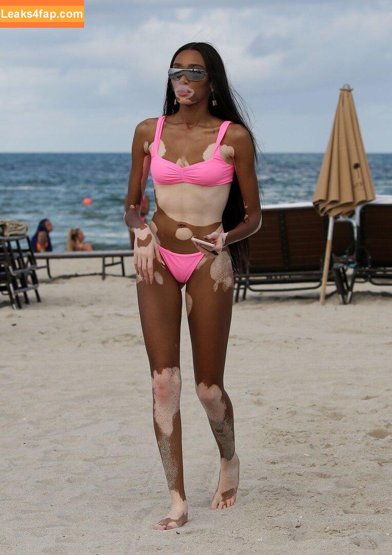 Winnie Harlow / winnieharlow слитое фото фото #0083