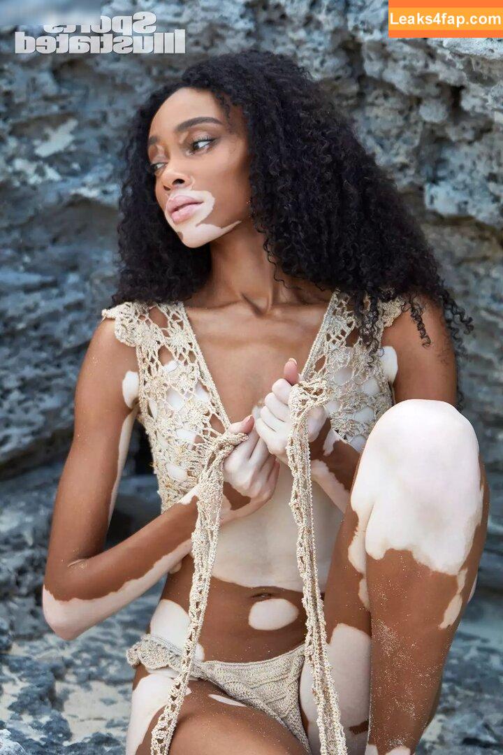 Winnie Harlow / winnieharlow слитое фото фото #0085