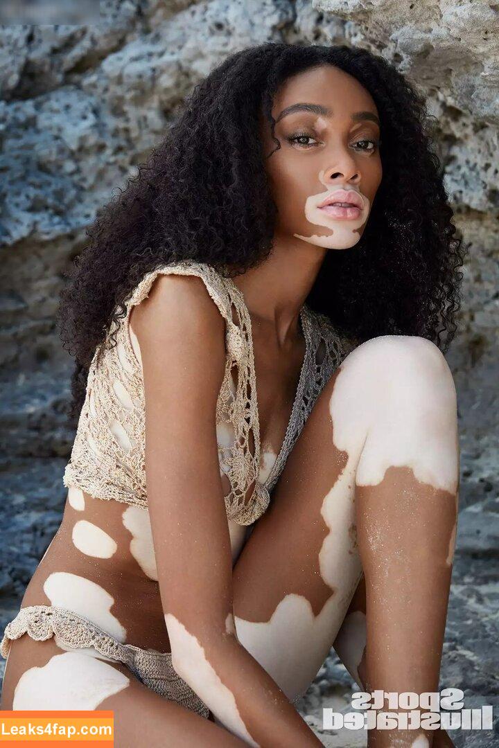 Winnie Harlow / winnieharlow слитое фото фото #0086