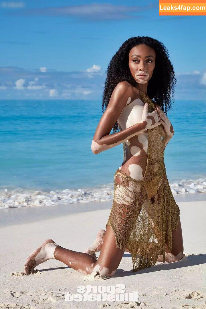 Winnie Harlow / winnieharlow слитое фото фото #0087