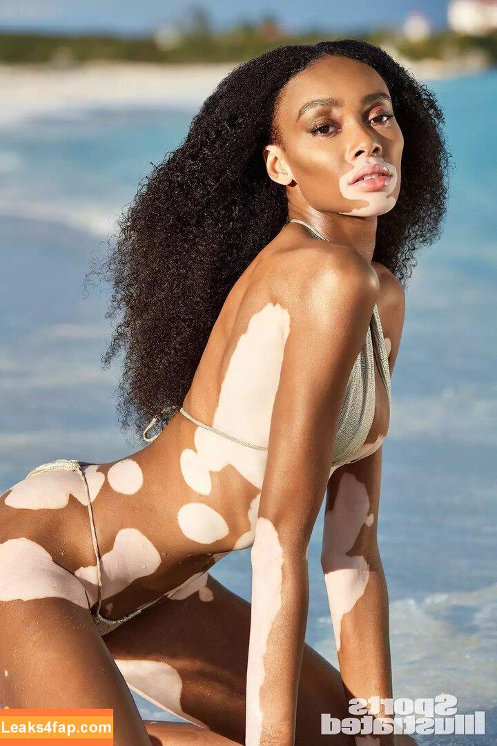 Winnie Harlow / winnieharlow слитое фото фото #0088