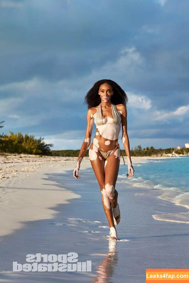 Winnie Harlow / winnieharlow слитое фото фото #0090