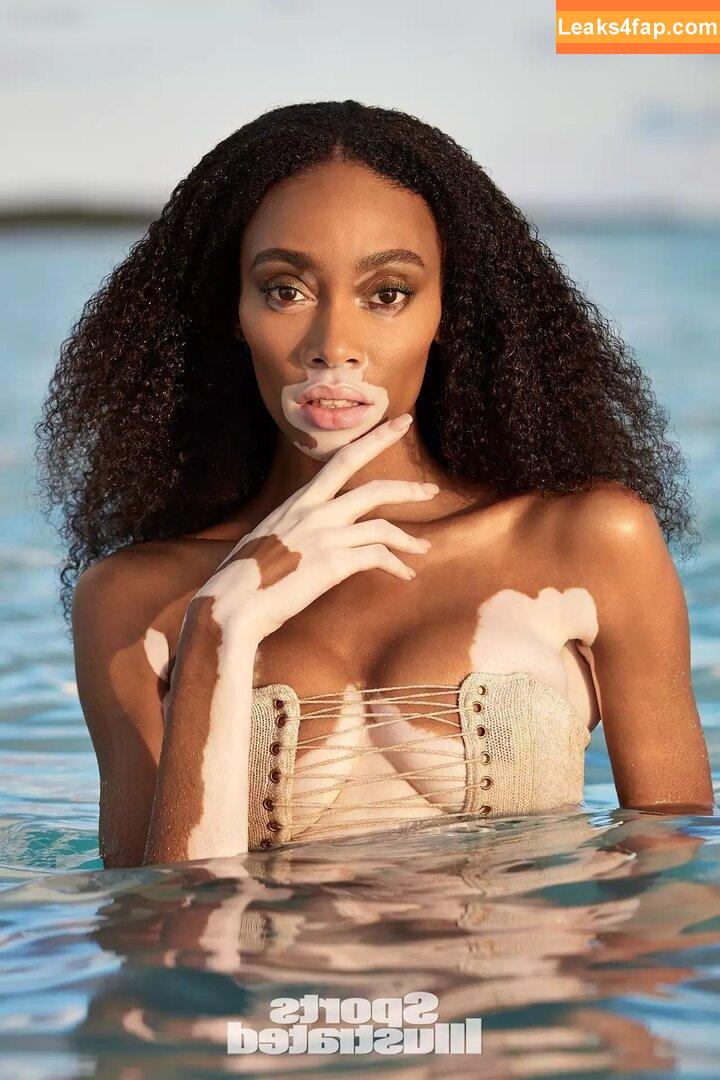 Winnie Harlow / winnieharlow слитое фото фото #0091