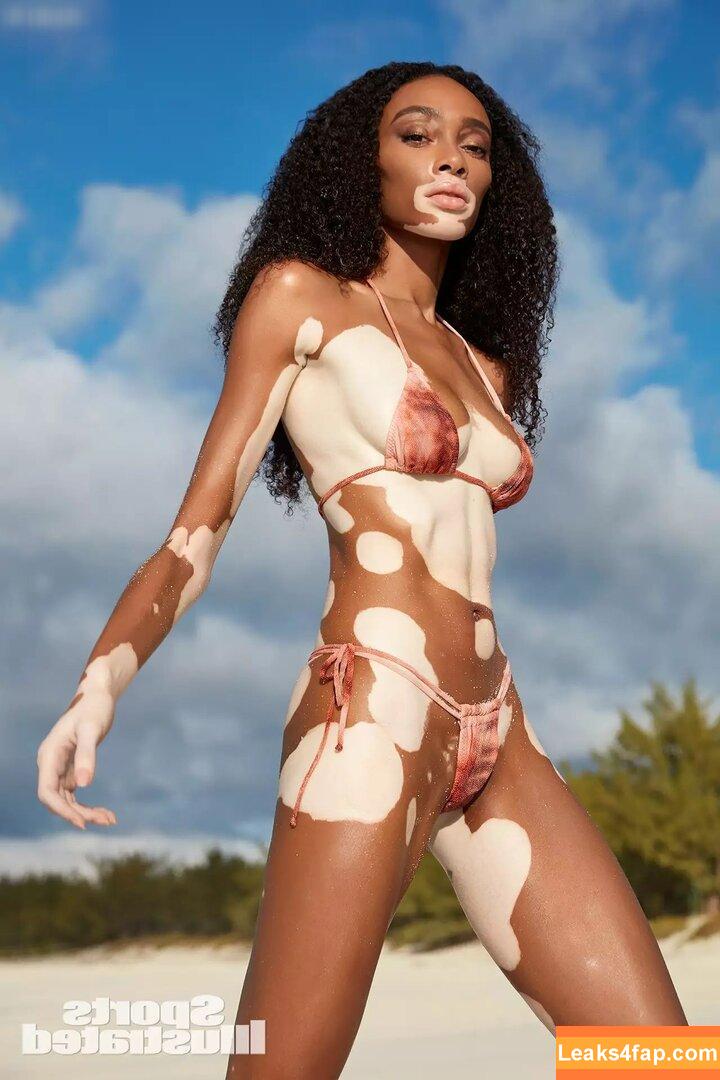 Winnie Harlow / winnieharlow слитое фото фото #0093