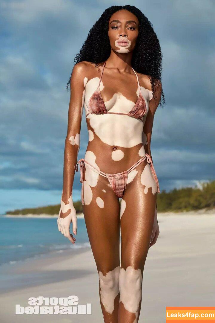 Winnie Harlow / winnieharlow слитое фото фото #0094