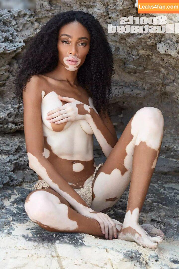 Winnie Harlow / winnieharlow слитое фото фото #0097