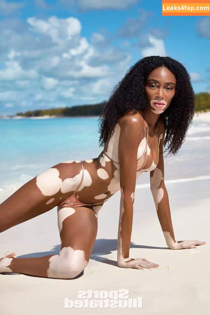 Winnie Harlow / winnieharlow слитое фото фото #0100