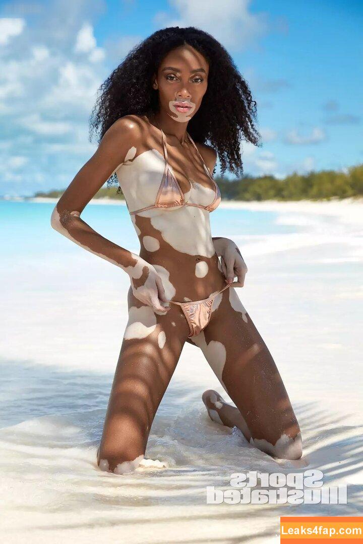 Winnie Harlow / winnieharlow слитое фото фото #0101