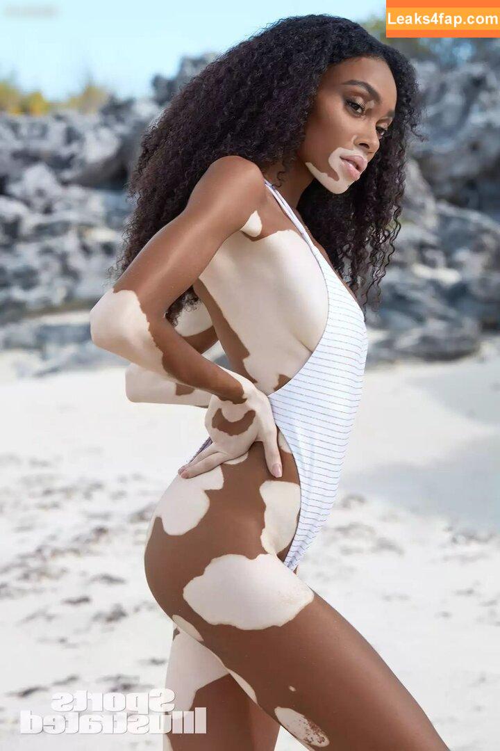 Winnie Harlow / winnieharlow слитое фото фото #0105