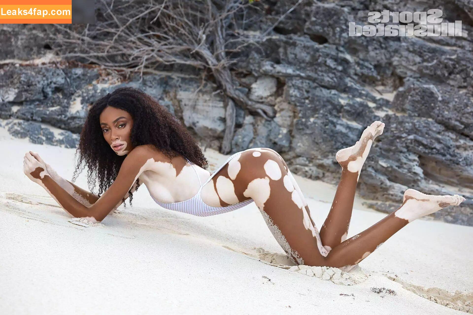 Winnie Harlow / winnieharlow слитое фото фото #0106