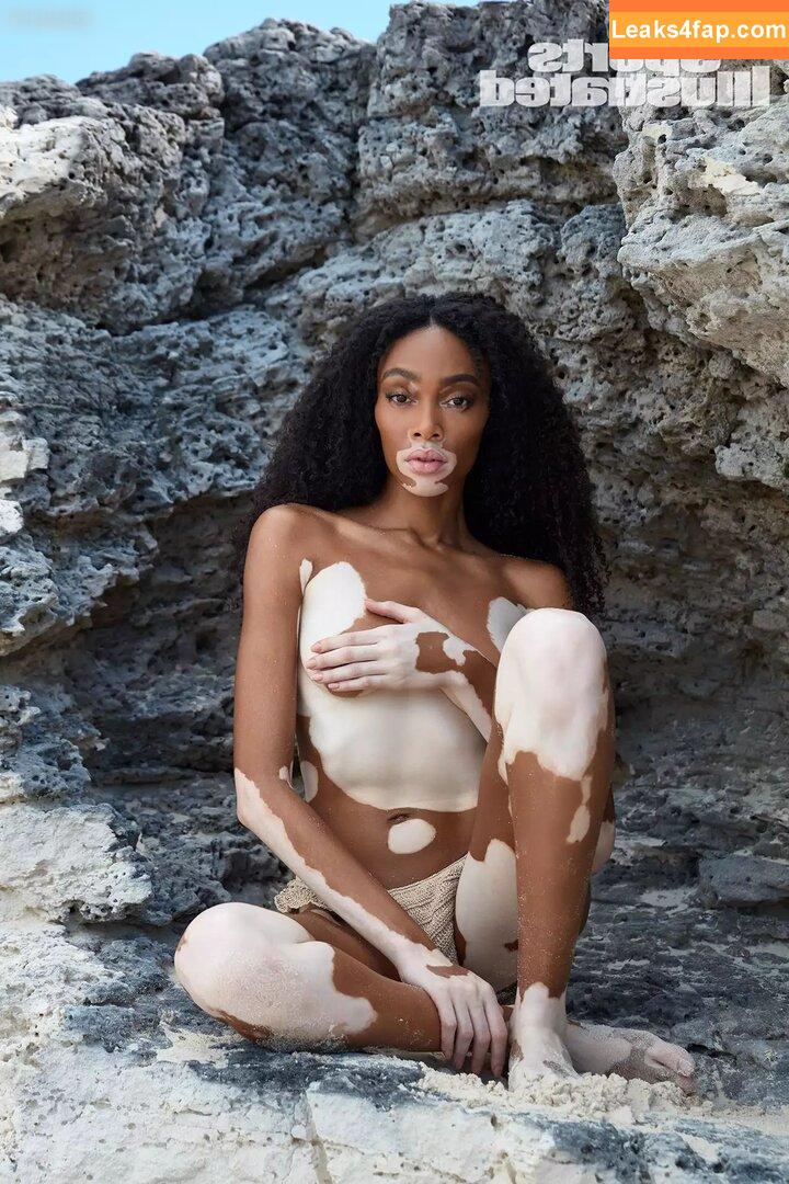 Winnie Harlow / winnieharlow слитое фото фото #0108