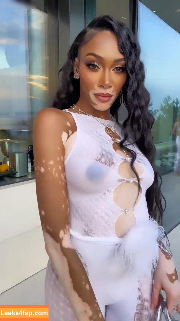 Winnie Harlow / winnieharlow leaked photo photo #0119