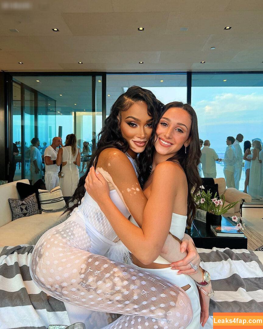 Winnie Harlow / winnieharlow слитое фото фото #0123